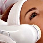 Radiofrecuencia facial contraindicaciones y todo lo que deberías de saber