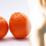 tratamiento lipolaser